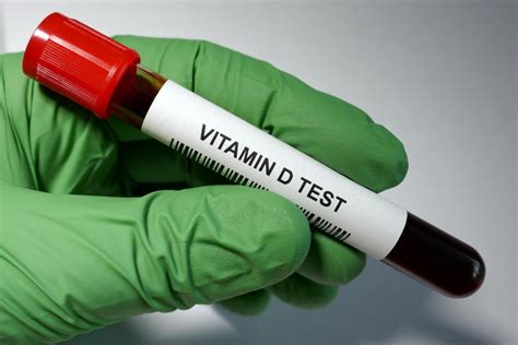 vit d blood test bottle|250h vitamin d test.